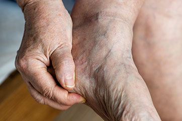 patient needing peripheral neuropathy treatment in Orange