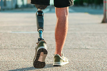 patient needing phantom limb syndrome treatment in Orange