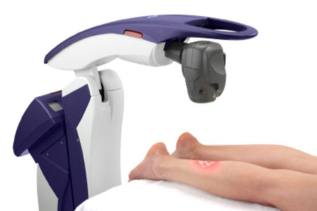 patient receiving m6 laser treatment in Orange